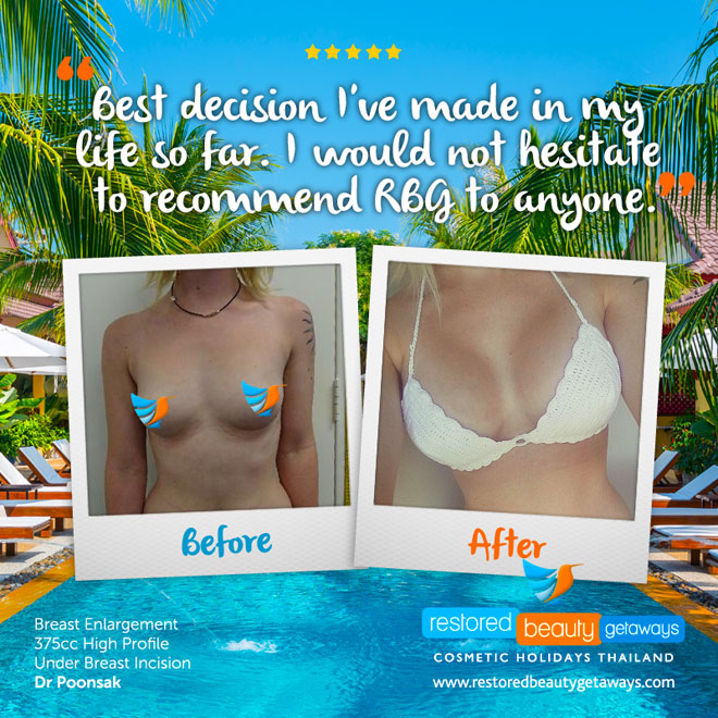 Boob Implants Australia - Breast Augmentation Australia & Thailand
