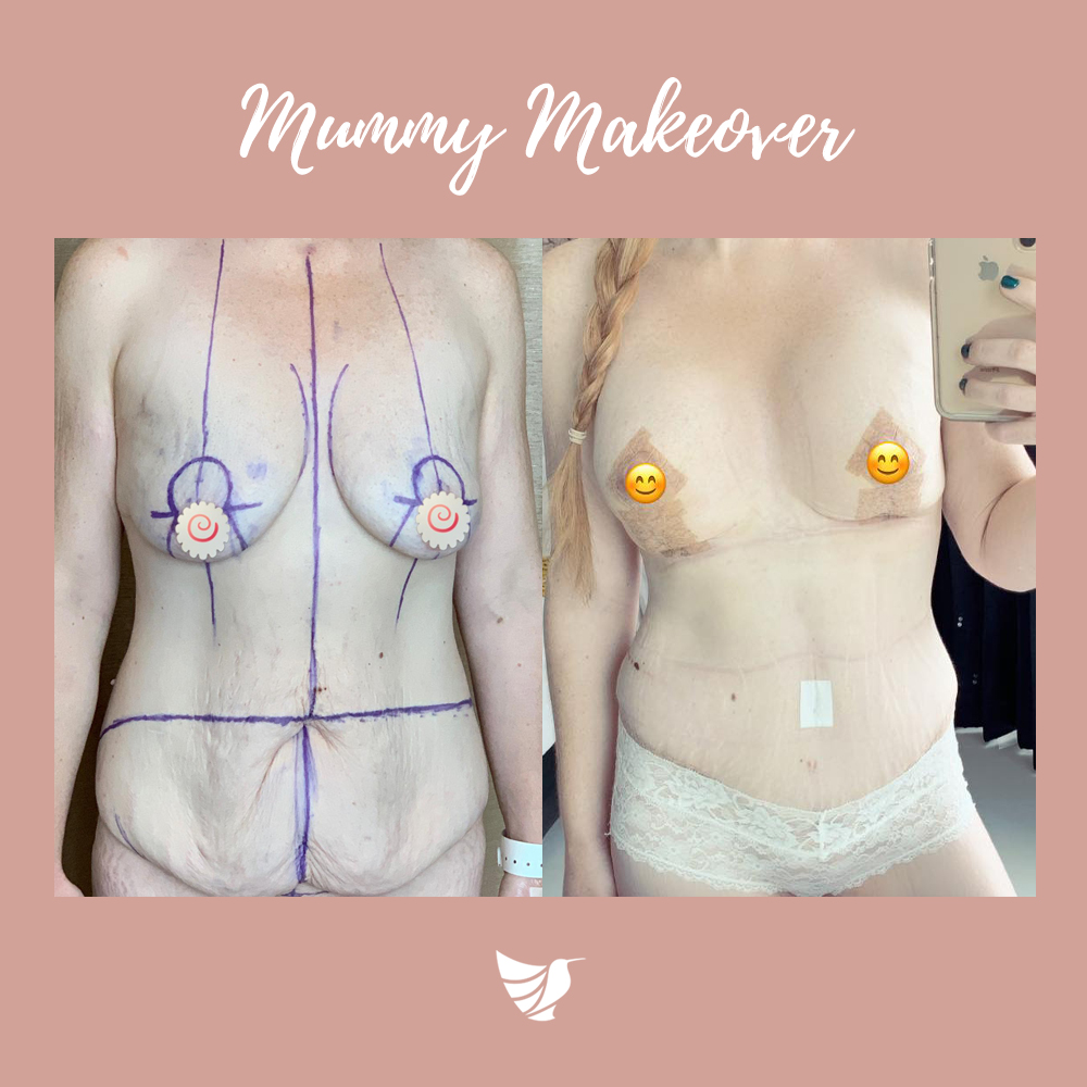 Mummy Makeover - Restored Beauty Getaways